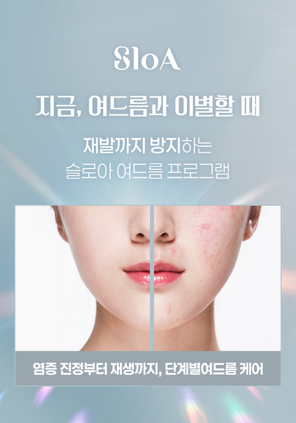 슬로아 여드름